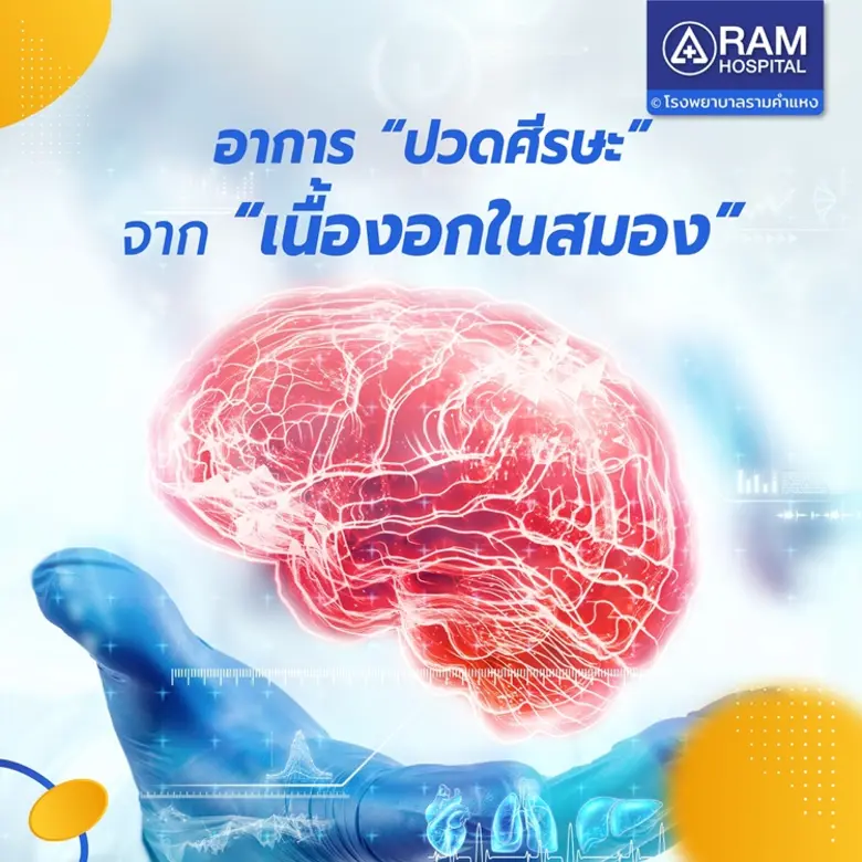 อาการ "ปวดศีรษะ" จาก "เนื้องอกในสมอง"