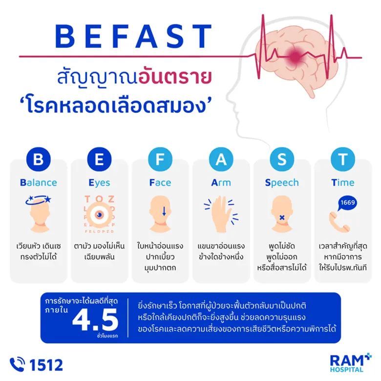 BEFAST สัญญาณอันตราย "โรคหลอดเลือดสมอง" โรคหลอดเลือ...