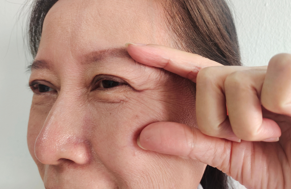 เช็กลิสต์สัญญาณผิวหย่อนคล้อย