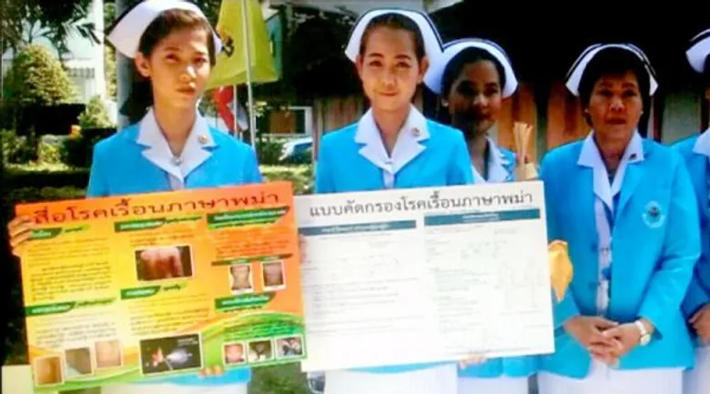 กรมควบคุมโรค ร่วมกับ อสม.ต่างด้าว เร่งค้นหาผู้ป่วยโรคเรื้อนรายใหม่ ป้องกันควบคุมโรคเรื้อนในประชากรต่างด้าว
