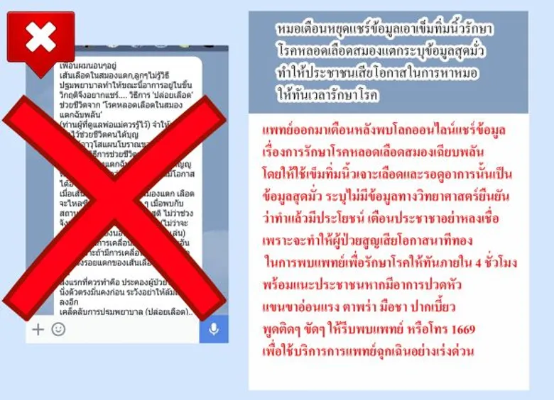 แพทย์ออกมาเตือนหลังพบโลกออนไลน์แชร์ข้อมูลเรื่องการรักษาโรคหลอดเลือดสมองเฉียบพลันโดยให้ใช้เข็มทิ่มนิ้วเจาะเลือดและรอดูอาการนั้นเป็นข้อมูลสุดมั่ว