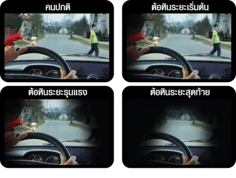 ชมรมต้อหินแห่งประเทศไทย และราชวิทยาลัยจักษุแพทย์แห่งประเทศไทย แจ้งเตือนคนไทยระวังโรคต้อหิน ชวนรีบไปตรวจสุขภาพตาในโรงพยาบาลใกล้บ้านป้องกันอาการบานปลาย คาดปี 2563 จะมีจำนวนผู้ป่วยโรคต้อหินทั่วโลกเพิ่มถึง76 ล้านคน