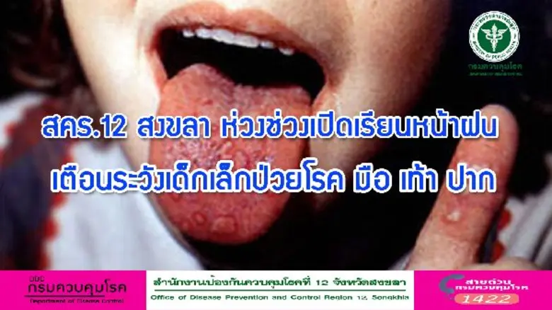 สำนักงานป้องกันควบคุมโรคที่ 12 จังหวัดสงข...