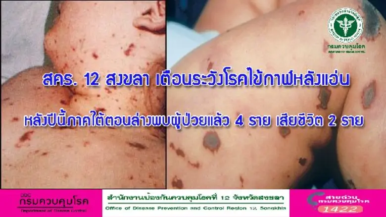 สำนักงานป้องกันควบคุมโรคที่ 12 จังหวัดสงข...