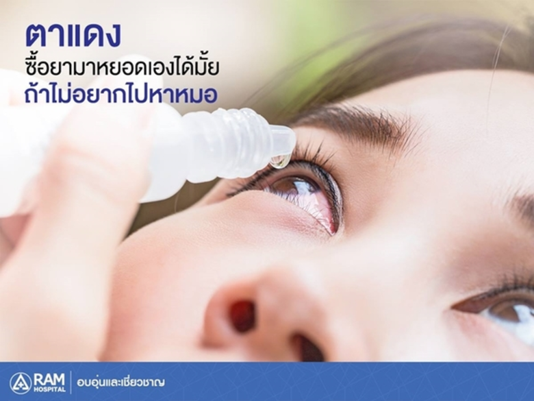 อาการตาแดงส่วนใหญ่มักเกิดจากเชื้อแบคทีเรี...