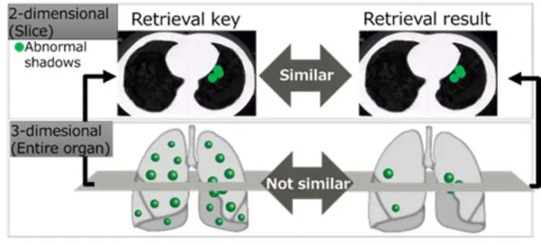 Fujitsu Develops AI-Based Technology to Retrieve Similar Disease Cases in CT Inspections
