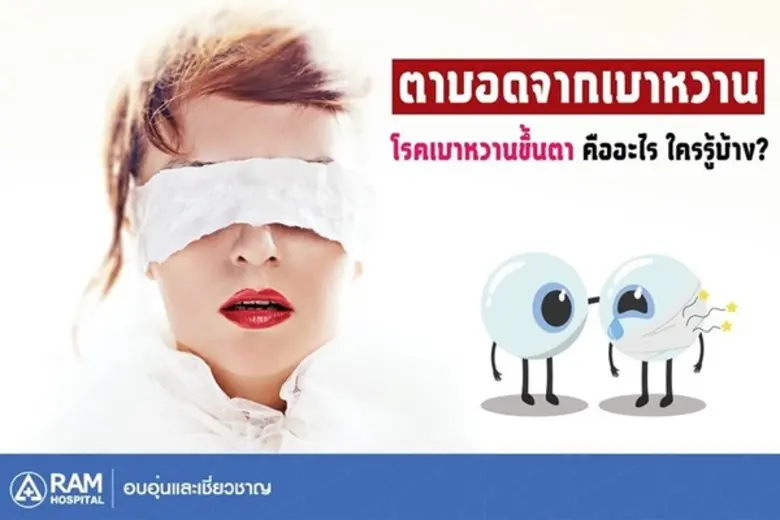 เบาหวานขึ้นตา คืออะไร? ใครรู้บ้าง