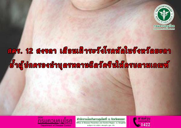 สำนักงานป้องกันควบคุมโรคที่ 12 จังหวัดสงข...