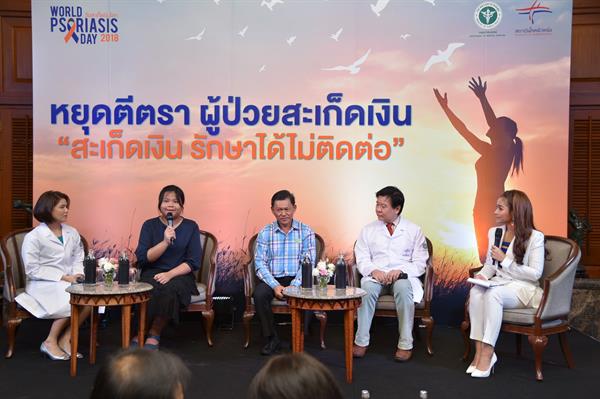สถาบันโรคผิวหนัง ชวนสังคมไทย “หยุดตีตรา ผู้ป่วยโรคสะเก็ดเงิน” เร่งสร้างองค์ความรู้ผ่าน E-Book หวังผู้ป่วยกว่าแสนราย มีคุณภาพชีวิตที่ดีขึ้น