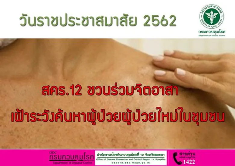 วันราชประชาสมาสัย 2562 สคร.12 ชวนร่วมจิตอาสา เฝ้าระวังค้นหาผู้ป่วยผู้ป่วยใหม่ในชุมชน