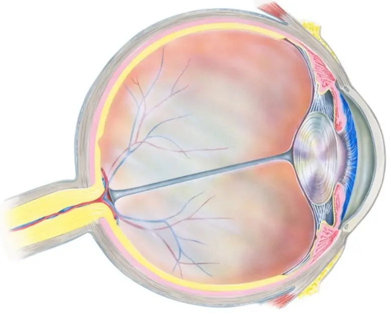 วุ้นตาเสื่อม (Vitreous degeneration)