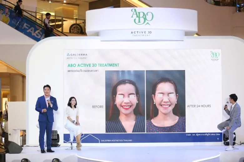 “กัลเดอร์มา” สร้างปรากฏการณ์ความสวยใน 24 ชั่วโมง เปิดตัว ABO Active 3D Treatment นวัตกรรมสารลดเลือนริ้วรอยจากประเทศอังกฤษ