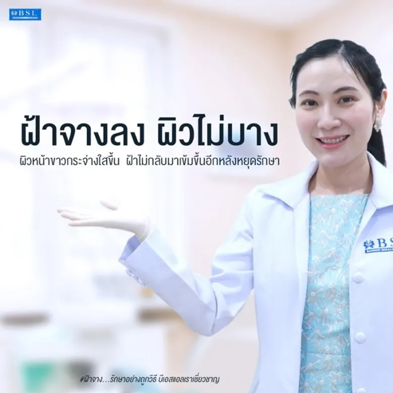 “ฝ้า” เป็นง่าย แต่หายไม่ยาก แค่รู้จักรักษาและป้องกันให้ถูกวิธี