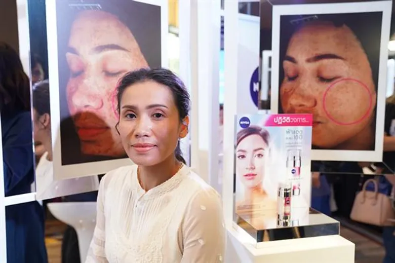 นีเวีย เปิดตัว สารปฏิวัติวงการฝ้าแดด “ลูมินัส 630” เป็นครั้งแรกในโลก ช่วยลดเลือนฝ้าแดดสะสม 10 ปี* ได้จริงใน 4 สัปดาห์** โดยไม่เกิดผลข้างเคียง***