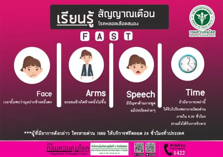 โรคหลอดเลือดสมอง (อัมพฤกษ์ อัมพาต) ป้องกันได้ สคร.12 สงขลา ย้ำ รู้เร็ว รักษาทัน ห่างไกลจากอัมพฤกษ์ อัมพาต