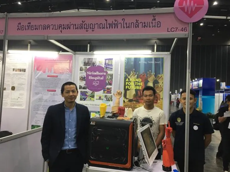 นักวิจัย สกสว.เจ๋ง ผลิต 'มือเทียมกล’ ควบคุมผ่านสัญญาณไฟฟ้าในกล้ามเนื้อ เพื่อคนพิการ
