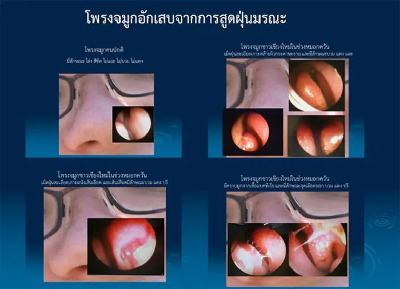ราชวิทยาลัยอายุรแพทย์ฯห่วง ! จากกรุงเทพฯถึงเชียงใหม่ค้นหาความจริงฝุ่นพิษมรณะ PM2.5