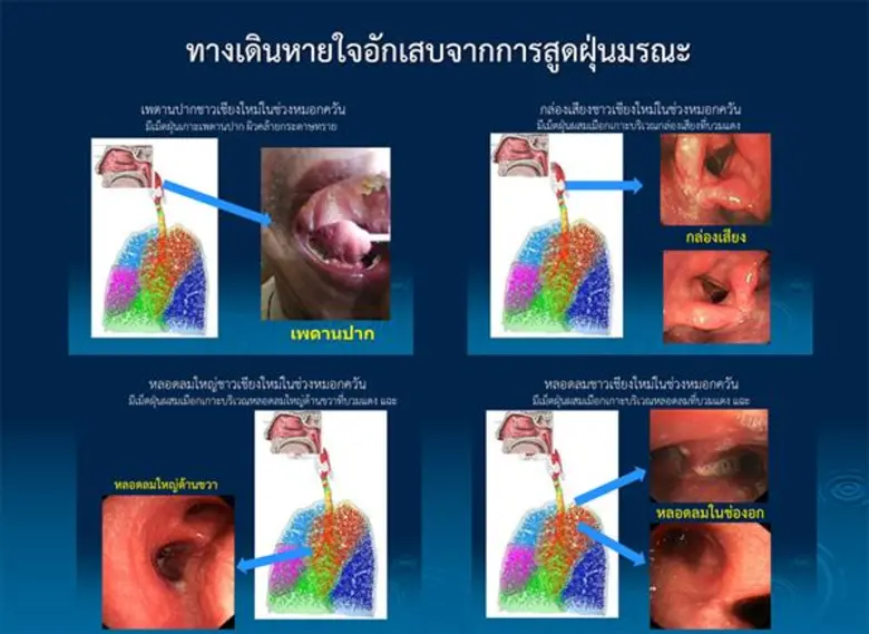 ราชวิทยาลัยอายุรแพทย์ฯห่วง ! จากกรุงเทพฯถึงเชียงใหม่ค้นหาความจริงฝุ่นพิษมรณะ PM2.5