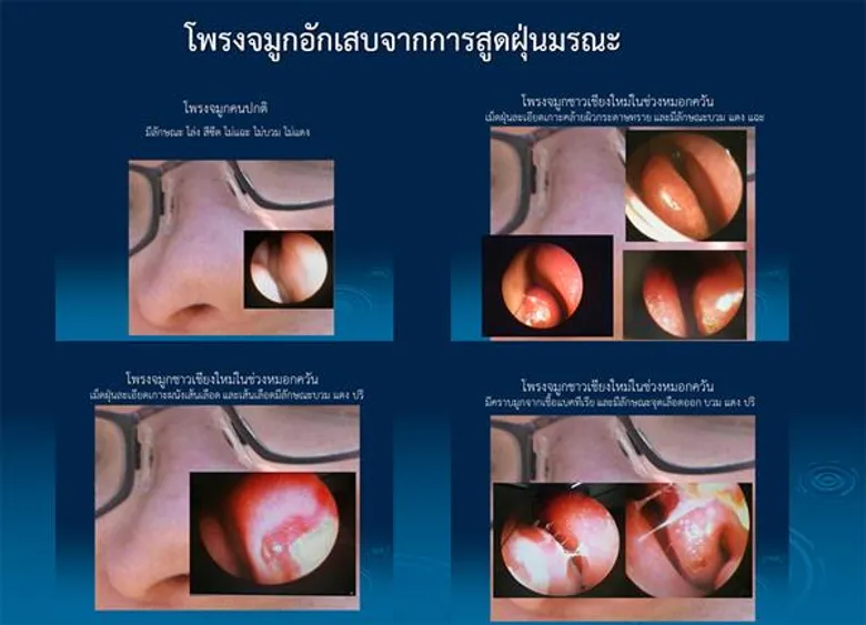 ราชวิทยาลัยอายุรแพทย์ฯห่วง ! จากกรุงเทพฯถึงเชียงใหม่ค้นหาความจริงฝุ่นพิษมรณะ PM2.5