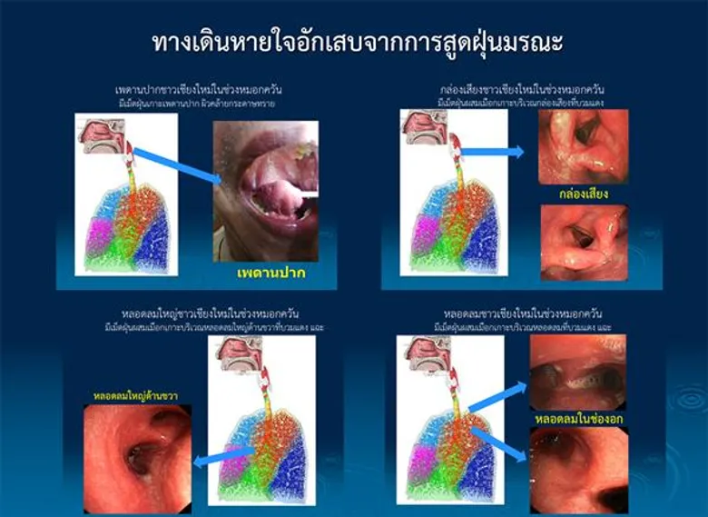 ราชวิทยาลัยอายุรแพทย์ฯห่วง ! จากกรุงเทพฯถึงเชียงใหม่ค้นหาความจริงฝุ่นพิษมรณะ PM2.5