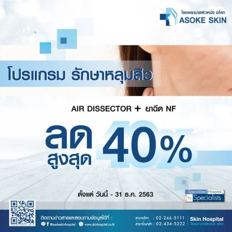 หยุดปัญหาหลุมสิวบนใบหน้า โรงพยาบาลผิวหนังอโศก ชวนมา...