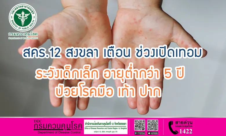สคร.12 สงขลา เตือน ช่วงเปิดเทอม ระวังเด็กเล็ก อายุต่ำกว่า 5 ปี ป่วยโรคมือ เท้า ปาก