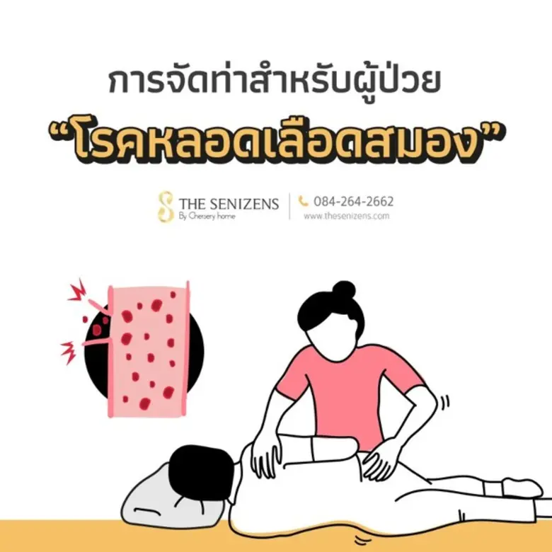 การจัดท่าสำหรับผู้ป่วยโรคหลอดเลือดสมอง โร...