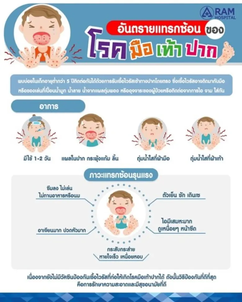 “มือ เท้า ปาก” เป็นโรคที่พบบ่อยในเด็กทารก เด็กเล็กต...
