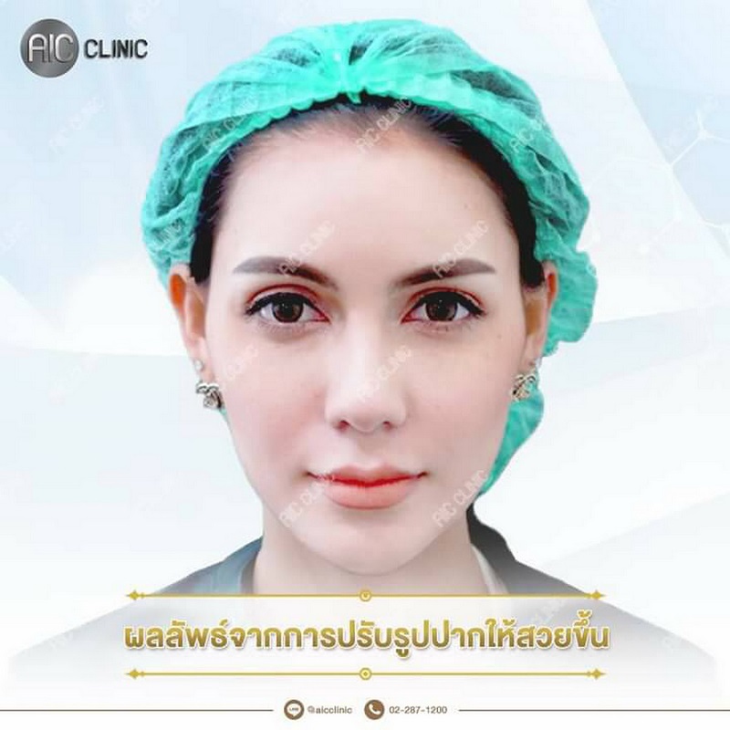 'ริมฝีปาก’ ถือเป็นจุดสำคัญของใบหน้า ที่มั...