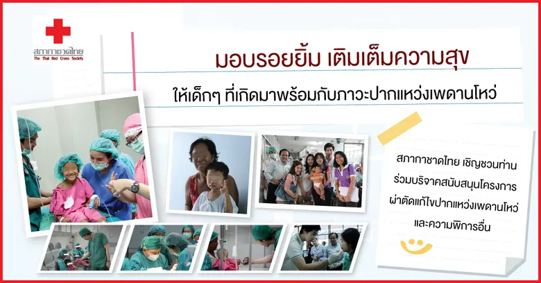 "ภาวะปากแหว่งเพดานโหว่และความพิการอื่น เป...