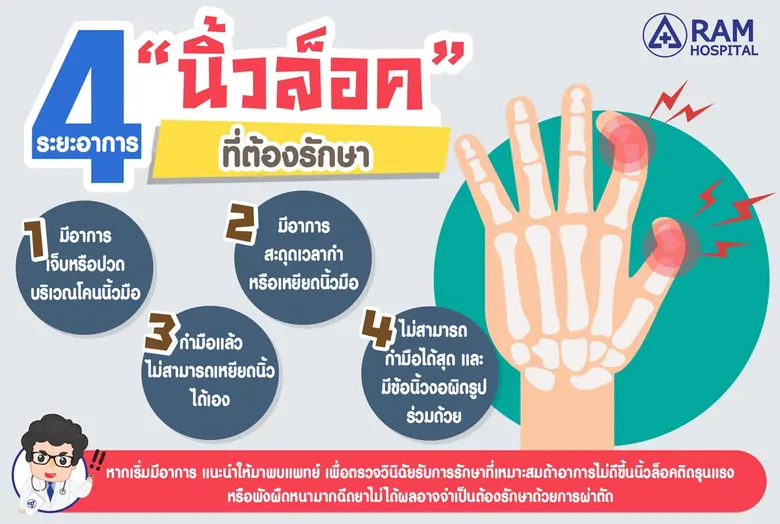 4 ระยะอาการ "นิ้วล็อค" ที่ต้องรักษา "นิ้ว...