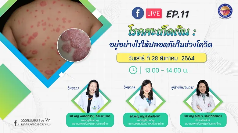 สมาคมแพทย์ผิวหนังแห่งประเทศไทยหรือ DST ตร...