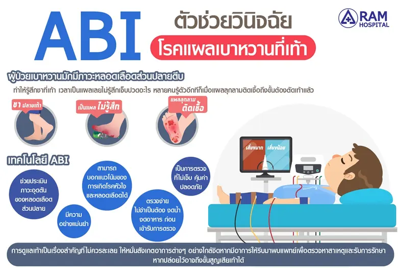 ABI ตัวช่วยวินิจฉัย "โรคแผลเบาหวานที่เท้า" ในผู้ป่ว...