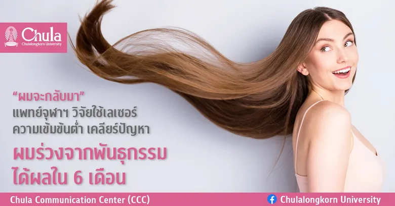 "ผมจะกลับมา" แพทย์จุฬาฯ วิจัยใช้เลเซอร์ความเข้มข้นต่ำ เคลียร์ปัญหาผมร่วงจากพันธุกรรมได้ผลใน 6 เดือน