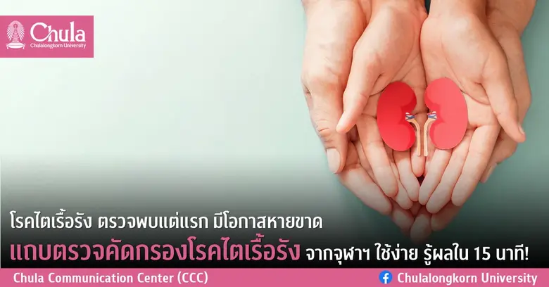 แถบตรวจคัดกรองโรคไตเรื้อรังจากจุฬาฯ ใช้ง่ายรู้ผลใน 15 นาที