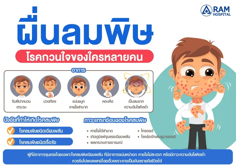 "ผื่นลมพิษ" โรคกวนใจของใครหลายคน