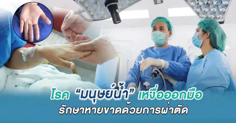 โรค "มนุษย์น้ำ" เหงื่อออกมือรักษาหายขาดด้วยการผ่าตัด
