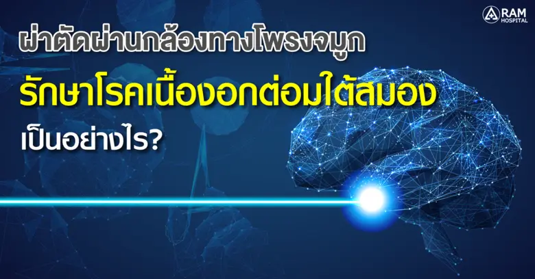 ผ่าตัดผ่านกล้องทางโพรงจมูกรักษา "โรคเนื้องอกต่อมใต้สมอง" เป็นอย่างไร?