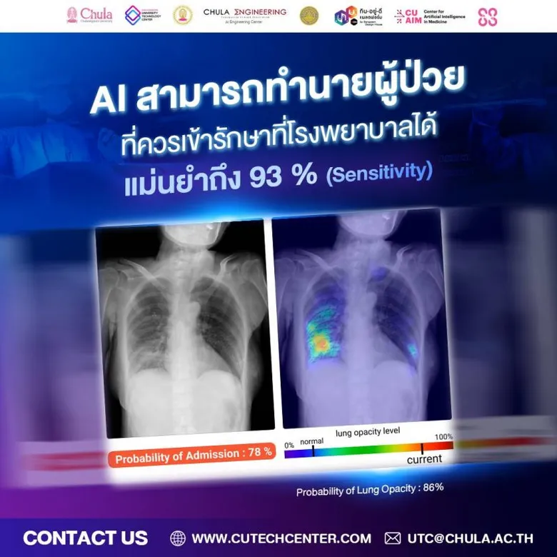 จุฬาฯ ผนึกกำลังนักวิจัยพัฒนา AI รับมือ "โอมิครอน" ดูแลผู้ป่วยโควิดแบบ Home Isolation