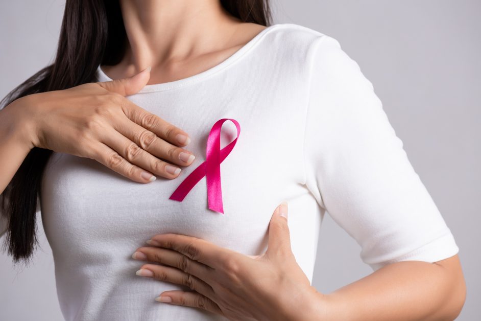 Breast Cancer Positive Alliance ทุกภาคส่วนร่วมเสนอยุทธศาสตร์ยกระดับการจัดการมะเร็งเต้านม ตั้งเป้าลดจำนวนหญิงไทยเสียชีวิตลง 30 % ในปี 2030