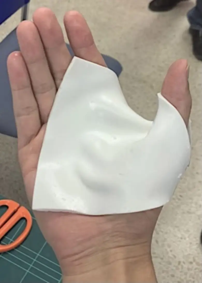 ม.มหิดล คิดค้นนวัตกรรมอุปกรณ์ดาม (Splint) เทอร์โมพลาสติกฝีมือคนไทย ด้วย "Design Thinking" คิดโจทย์จากผู้ใช้