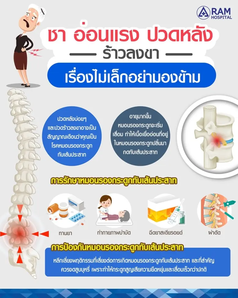 ชา อ่อนแรง ปวดหลังร้าวลงขา เรื่องไม่เล็ก อย่ามองข้าม