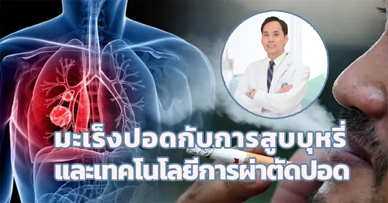 อย่างที่เราทราบกันว่า ทุกวันที่ 31 พฤษภาคม ของทุกปี...
