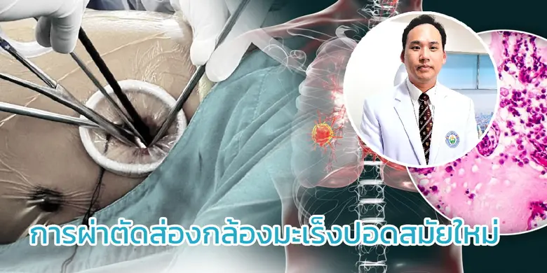 ในปี 2565 มีผู้ป่วยเป็นจำนวนมากที่ตรวจพบว...