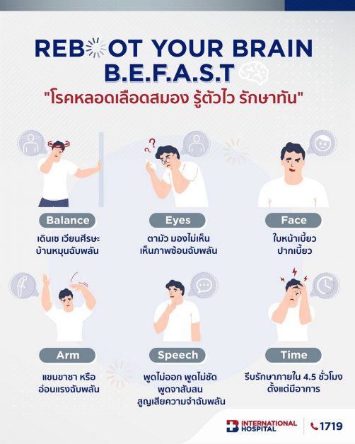สังเกตอาการเตือนโรคหลอดเลือดสมอง ตามหลักการ BEFAST รู้ไว ปลอดภัยจากโรคหลอดเลือดสมอง