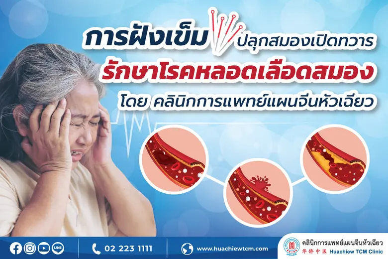 ศาสตร์การแพทย์แผนจีนเรียกโรคหลอดเลือดสมอง...