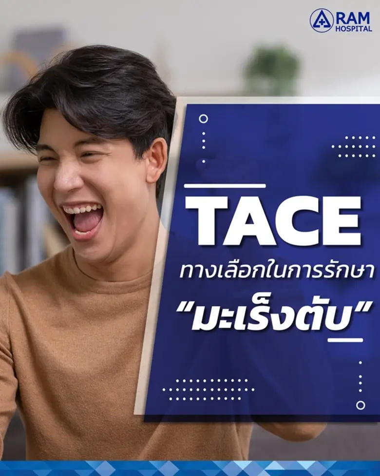 TACE ทางเลือกในการรักษา "มะเร็งตับ" การรั...