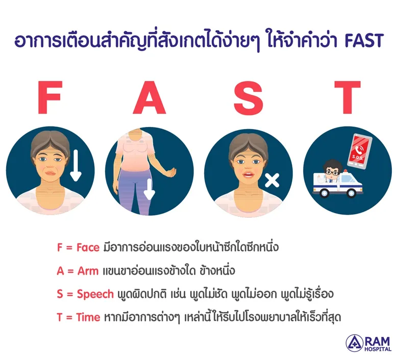 FAST โรคหลอดเลือดสมองสังเกตได้...ด้วยตัวคุณเอง