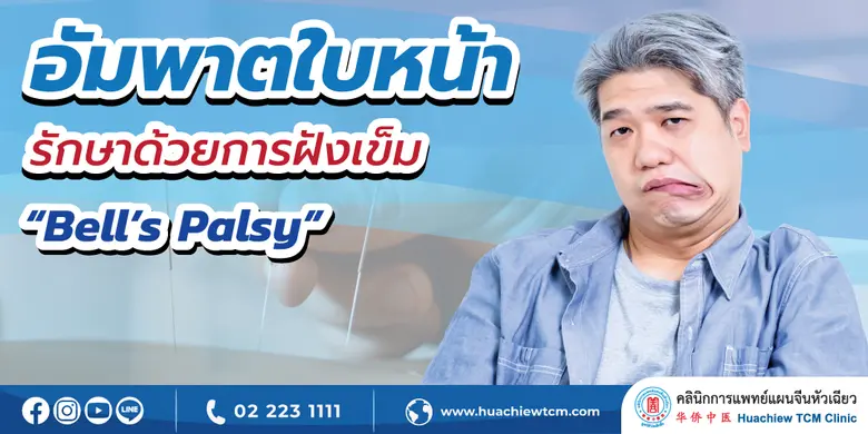 โรคอัมพาตใบหน้า "Facial paralysis" หรือ "Bell's Pal...