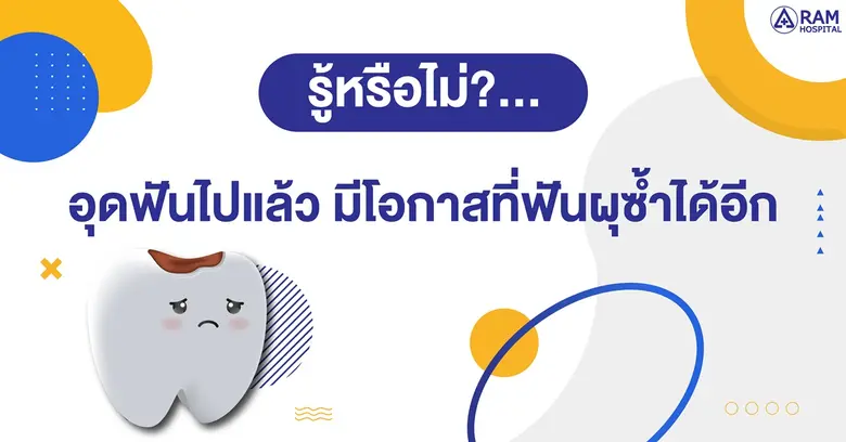 รู้หรือไม่?... อุดฟันไปแล้ว มีโอกาสที่ฟัน...